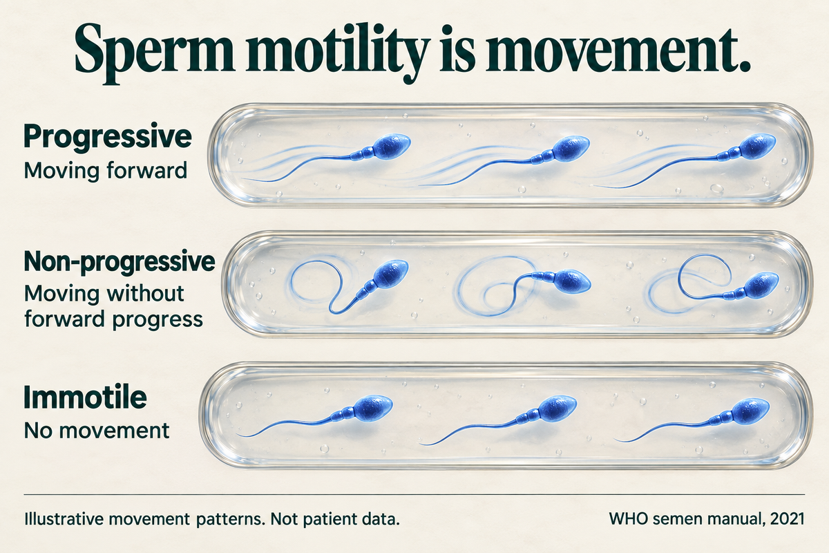 Sperm motility is movement. Progressive: moving forward. Non-progressive: moving without forward progress. Immotile: no movement. Illustrative movement patterns, not patient data. WHO semen manual, 2021.